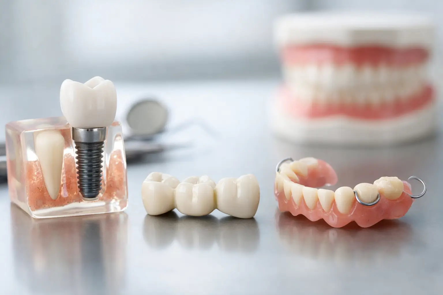 Best Ways to Replace Missing Teeth